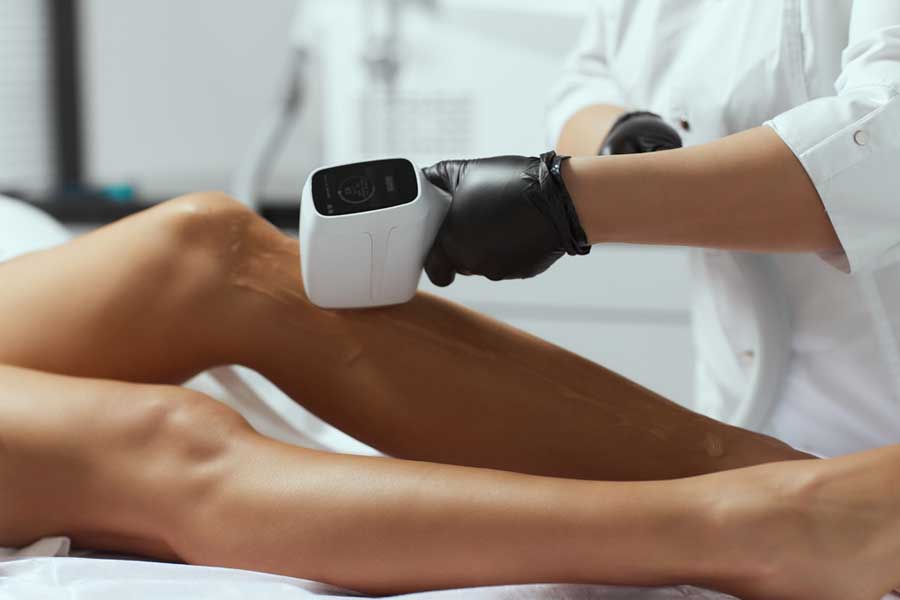 Laser hair removal lower legs